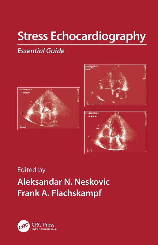 Stress Echocardiography: Essential Guide