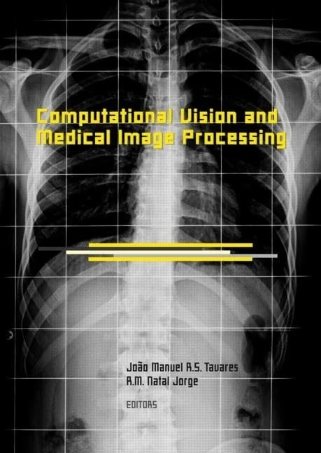 Computational Vision and Medical Image Processing: VipIMAGE 2007 (Balkema-Proceedings and Monographs in Engineering, Water, an)