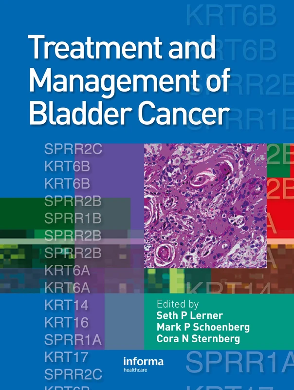 Treatment and Management of Bladder Cancer