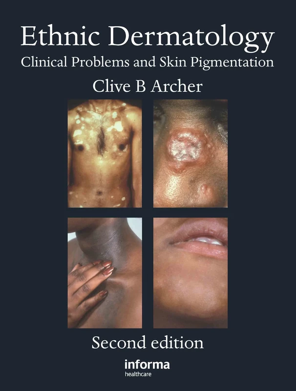 Ethnic Dermatology: Clinical Problems and Skin Pigmentation