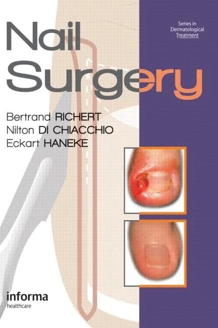 Nail Surgery: 7 (Series in Dermatological Treatment)
