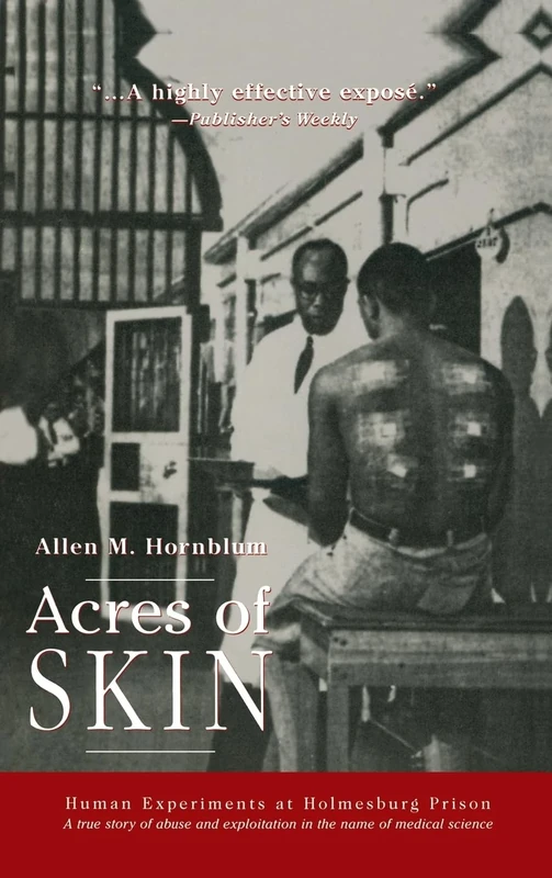 Acres of Skin: Human Experiments at Holmesburg Prison - Image 1