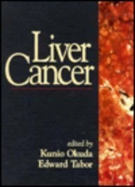 Liver Cancer