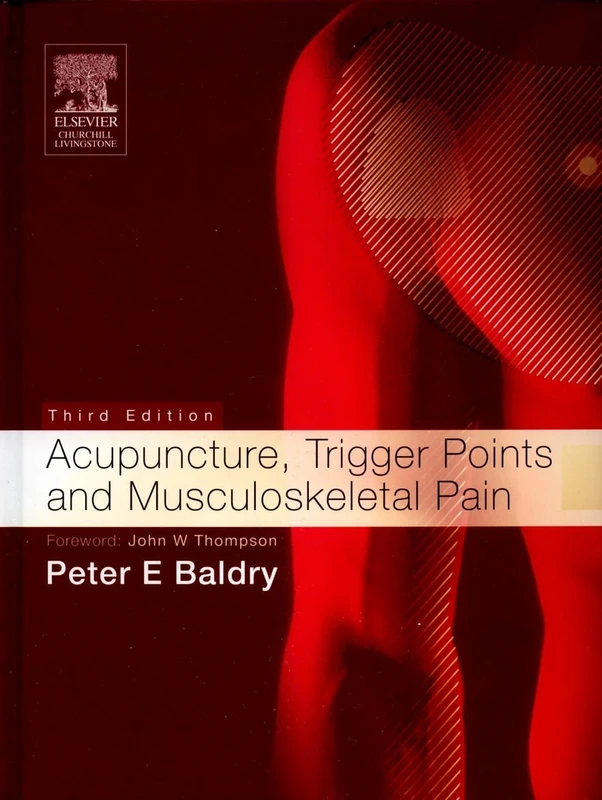 Acupuncture, Trigger Points and Musculoskeletal Pain