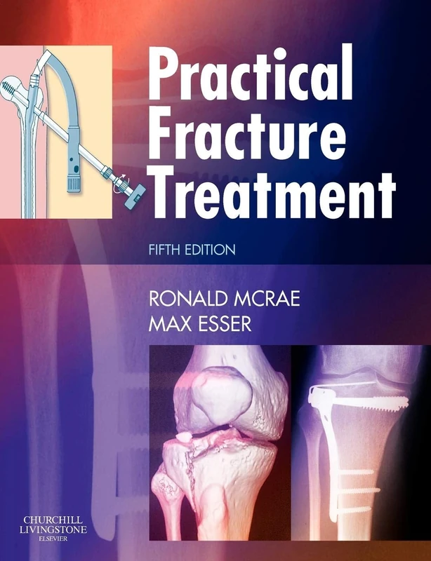 Practical Fracture Treatment, Fith Edition - Image 1