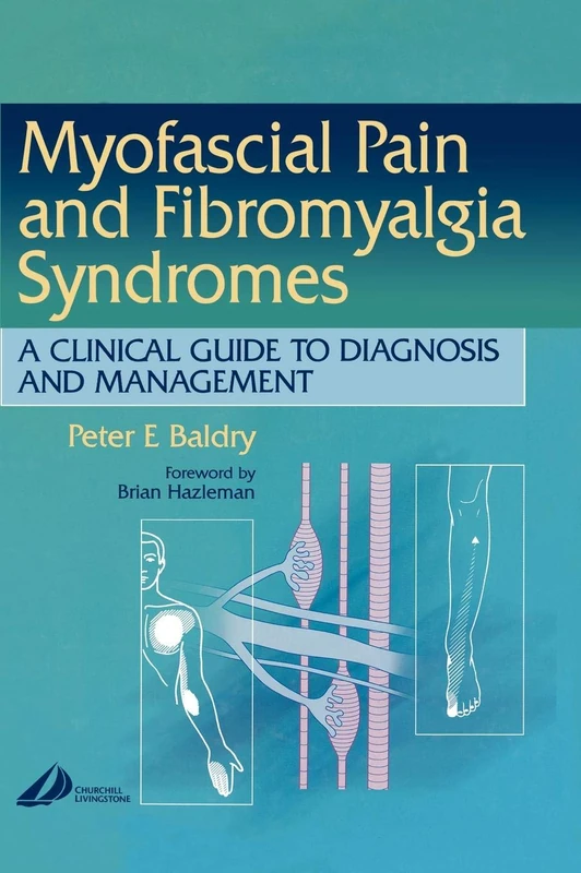Myofascial Pain and Fibromyalgia Syndromes: A Clinical Guide to Diagnosis and Management