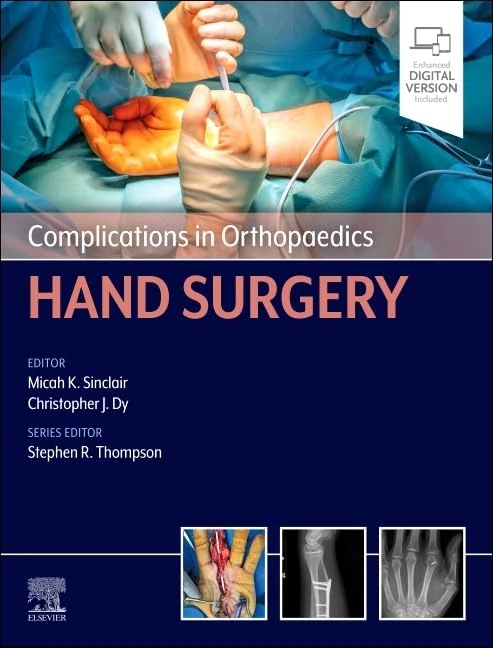 Complications in Orthopaedics: Hand Surgery