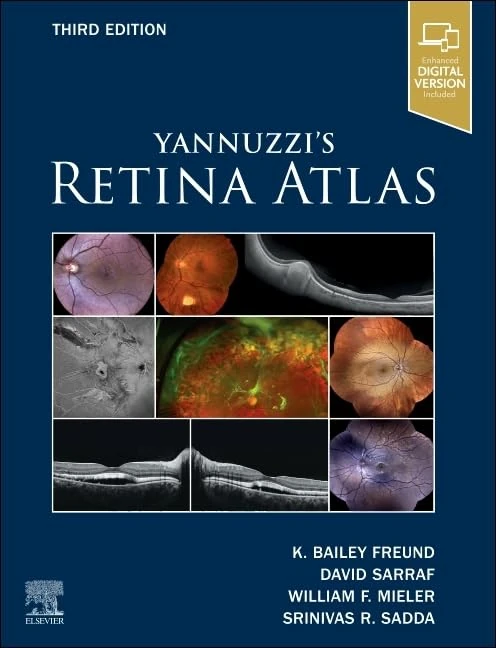Yannuzzi's Retina Atlas