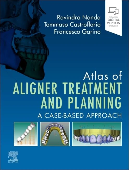 Atlas of Aligner Treatment and Planning: A Case-Based Approach