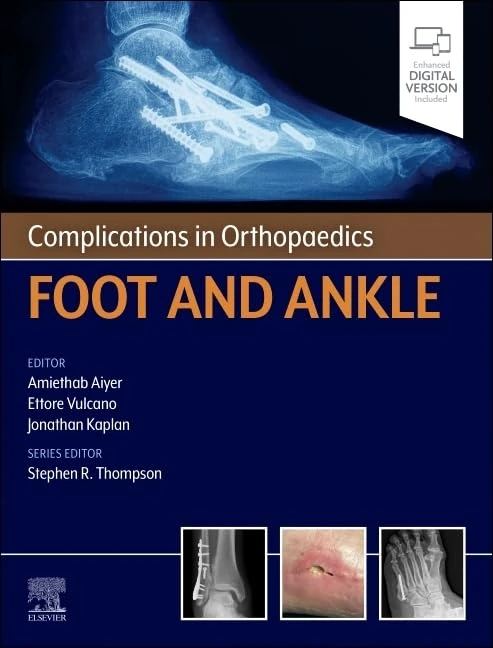 Complications in Orthopaedics: Foot and Ankle