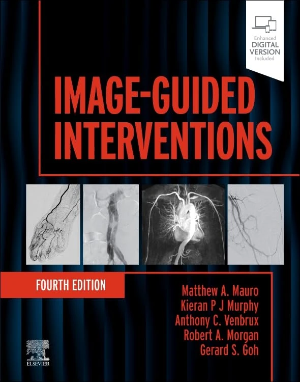 Image-Guided Interventions (Expert Radiology)