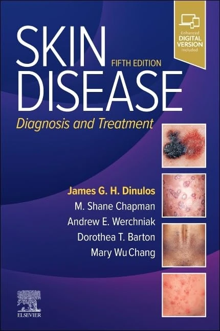 Skin Disease: Diagnosis and Treatment