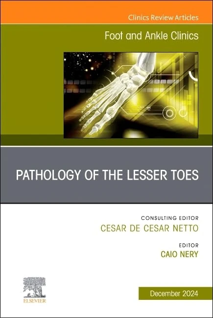 Pathology of the Lesser Toes, An issue of Foot and Ankle Clinics of North America (Volume 29-4) (The Clinics: Orthopedics, Volume 29-4)