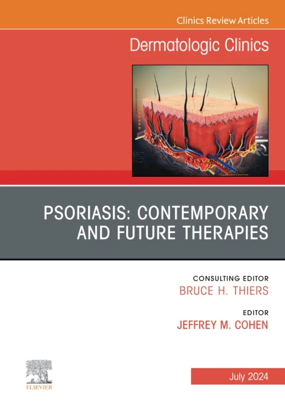 Psoriasis: Contemporary and Future Therapies, An Issue of Dermatologic Clinics, E-Book: Volume 42-3 (The Clinics: Dermatology, Volume 42-3)