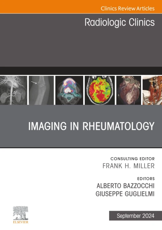 Imaging in Rheumatology, An Issue of Radiologic Clinics of North America: Volume 62-5 (The Clinics: Radiology, Volume 62-5)
