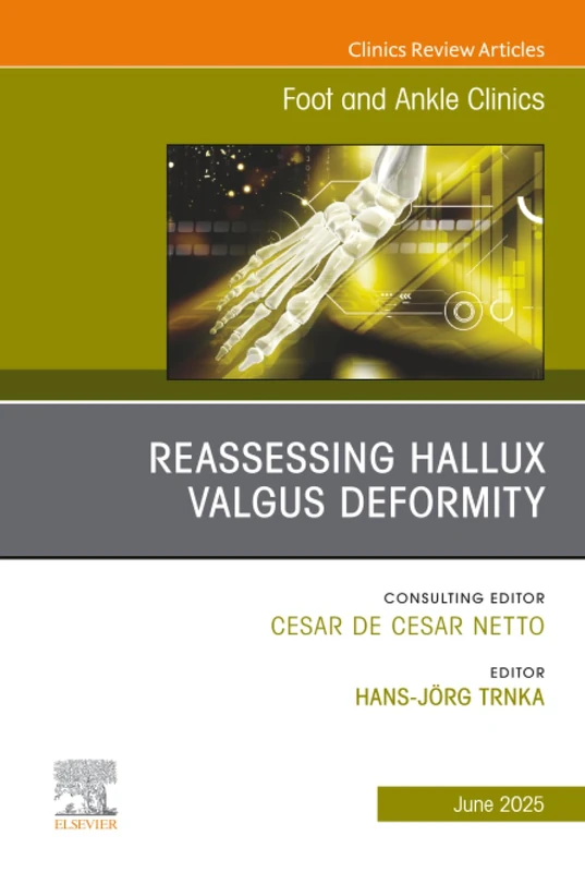 Reassessing Hallux Valgus Deformity, An Issue of Foot and Ankle Clinics of North America: Volume 30-2 (The Clinics: Orthopedics, Volume 30-2)