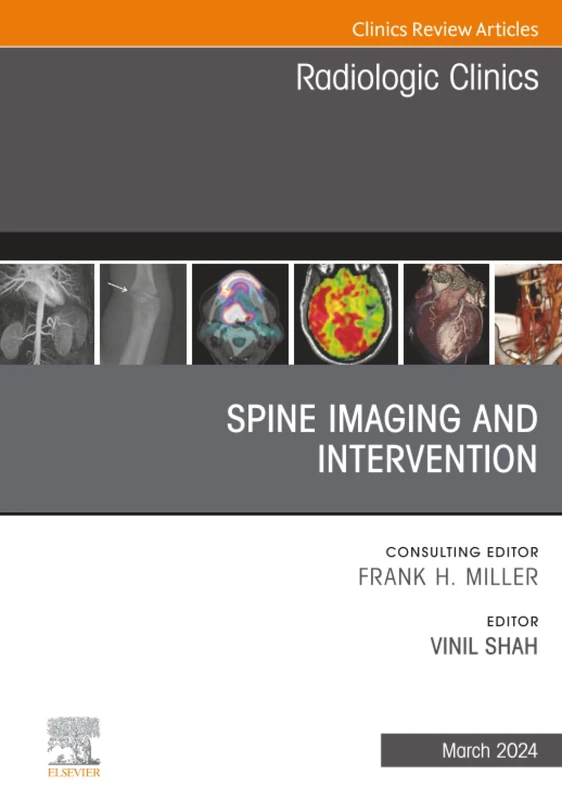 Spine Imaging and Intervention, An Issue of Radiologic Clinics of North America: Volume 62-2 (The Clinics: Radiology, Volume 62-2)