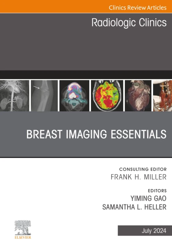 Breast Imaging Essentials, An Issue of Radiologic Clinics of North America: Volume 62-4 (The Clinics: Radiology, Volume 62-4)