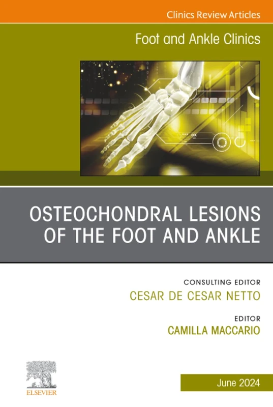 Osteochondral Lesions of the Foot and Ankle, An issue of Foot and Ankle Clinics of North America: Volume 29-2 (The Clinics: Orthopedics, Volume 29-2)