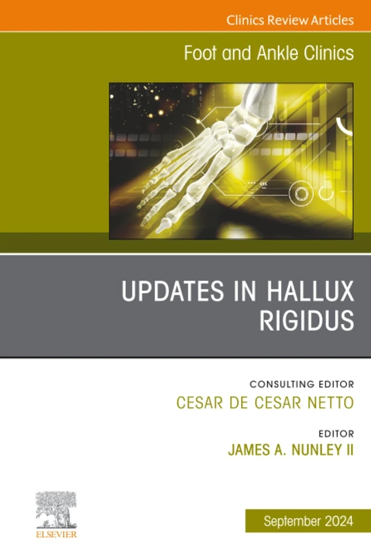 Updates in Hallux Rigidus, An issue of Foot and Ankle Clinics of North America: Volume 29-3 (The Clinics: Orthopedics, Volume 29-3)