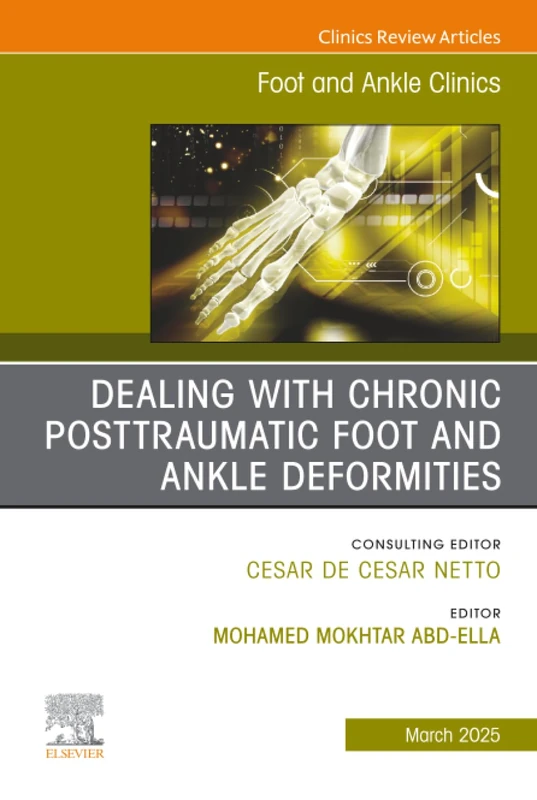 Dealing with Chronic Posttraumatic Foot and Ankle Deformities, An issue of Foot and Ankle Clinics of North America: Volume 30-1 (The Clinics: Orthopedics, Volume 30-1)