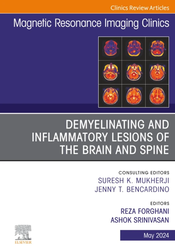 Demyelinating and Inflammatory Lesions of the Brain and Spine, An Issue of Magnetic Resonance Imaging Clinics of North America: Volume 32-2 (The Clinics: Radiology, Volume 32-2)