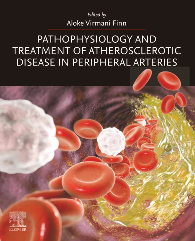 Elsevier Pathophysiology and Treatment of Atherosclerotic Disease
