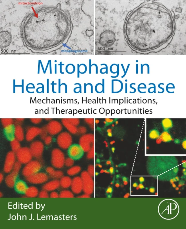 Academic Press - Mitophagy in Health and Disease Book