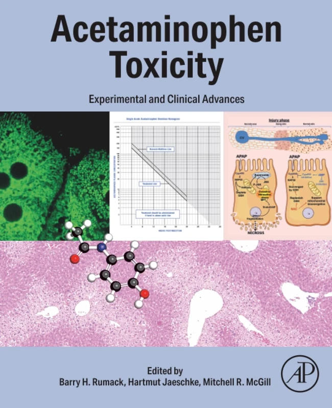 Academic Press - Acetaminophen Toxicity: Experimental Advances