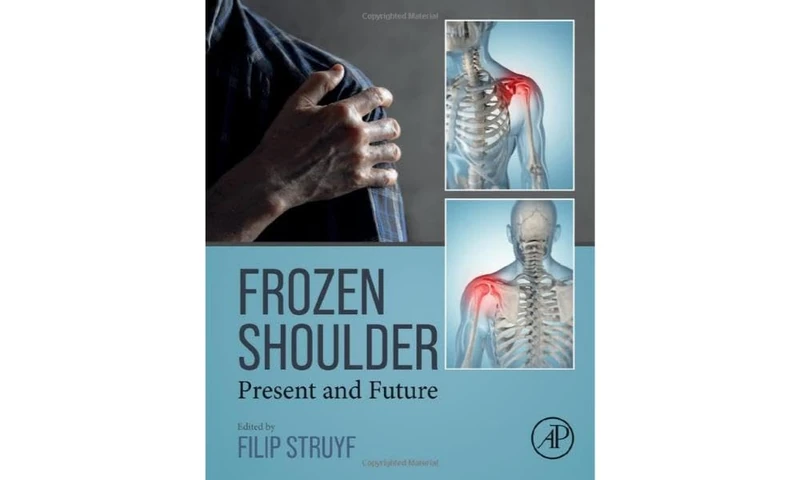 Frozen Shoulder: Present and Future - Image 1