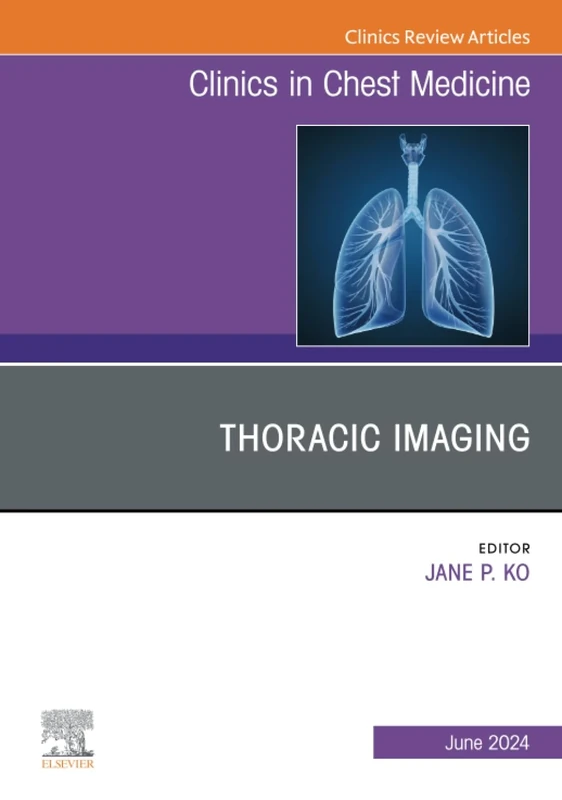 Thoracic Imaging, An Issue of Clinics in Chest Medicine, E-Book: Volume 45-2 (The Clinics: Internal Medicine, Volume 45-2)