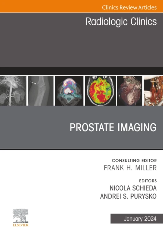 Prostate Imaging, An Issue of Radiologic Clinics of North America: Volume 62-1 (The Clinics: Radiology, Volume 62-1)