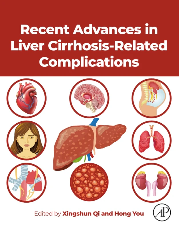 Academic Press - Recent Advances in Liver Cirrhosis Related Complications