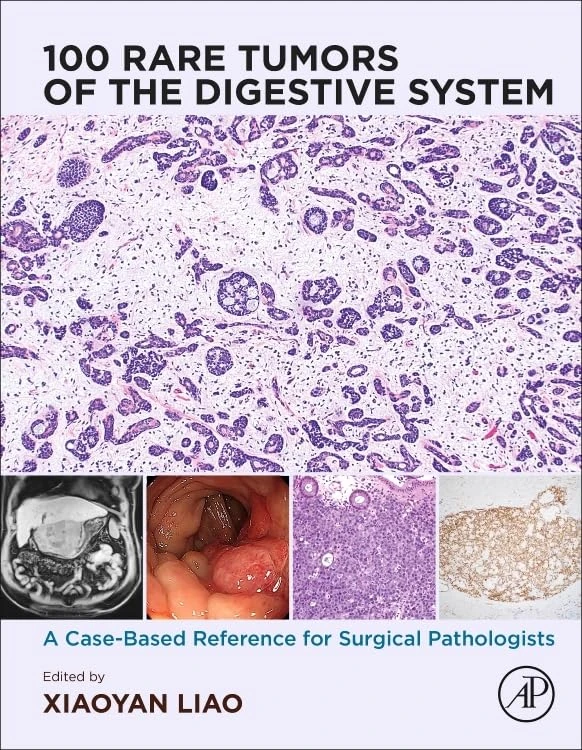 100 Rare Tumors of the Digestive System: A Case-Based Reference for Surgical Pathologists
