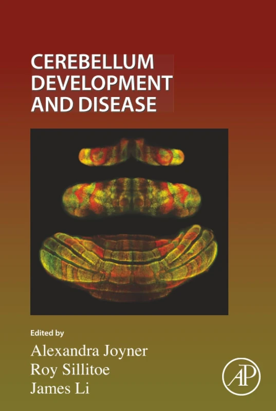 Academic Press Cerebellum Development and Disease Volume 167
