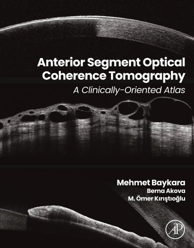 Academic Press: Anterior Segment Optical Coherence Tomography Atlas
