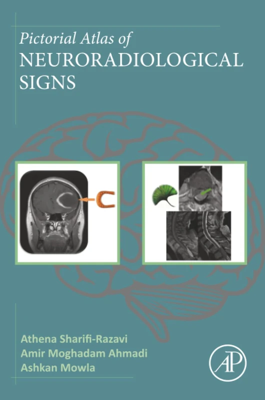 Pictorial Atlas of Neuroradiological Signs