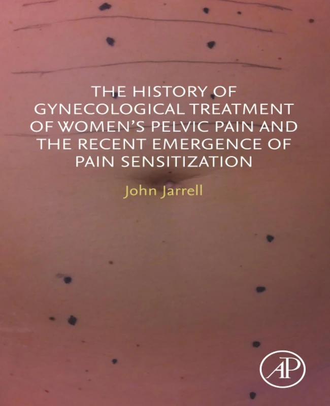 Academic Press - History of Gynecological Pelvic Pain Treatment
