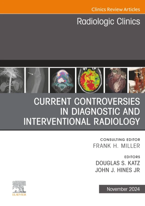 Current Controversies in Diagnostic and Interventional Radiology, An Issue of Radiologic Clinics of North America: Volume 62-6 (The Clinics: Radiology, Volume 62-6)