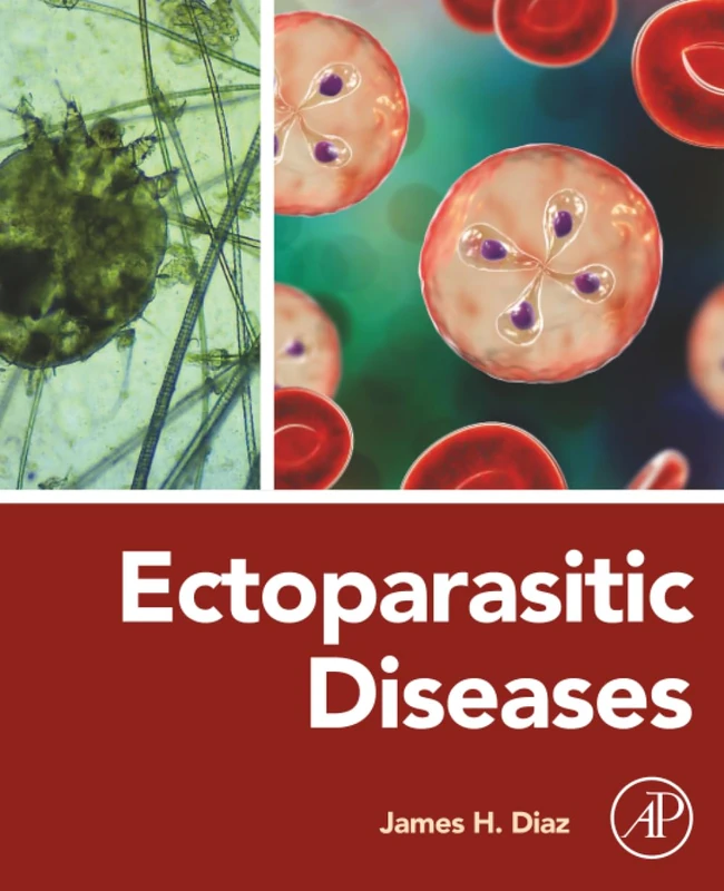 Ectoparasitic Diseases by Academic Press - Medical Textbook