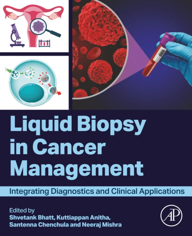 Academic Press - Liquid Biopsy in Cancer Management Book