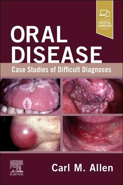 Oral Disease: Case Studies of Difficult Diagnoses: Case Studies of Difficult Diagnoses