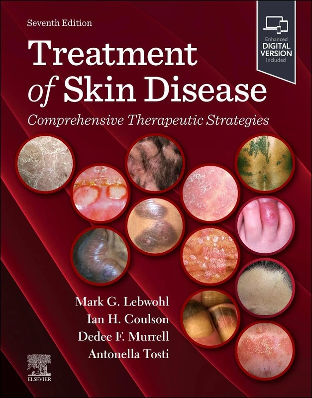 Treatment of Skin Disease: Comprehensive Therapeutic Strategies: Comprehensive Therapeutic Strategies