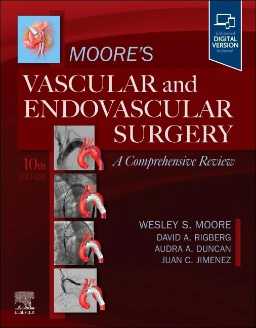Moore's Vascular and Endovascular Surgery: A Comprehensive Review: A Comprehensive Review