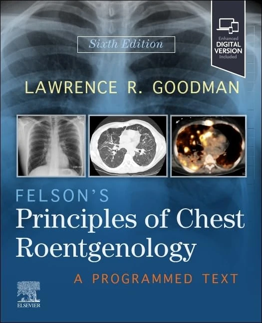 Felson's Principles of Chest Roentgenology: A Programmed Text