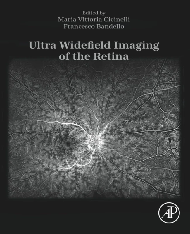 Academic Press - Ultra Widefield Imaging of the Retina Book