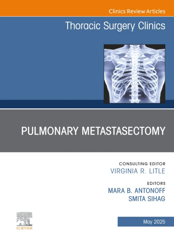Pulmonary Metastasectomy, An Issue of Thoracic Surgery Clinics: Volume 35-2 (The Clinics: Internal Medicine, Volume 35-2)