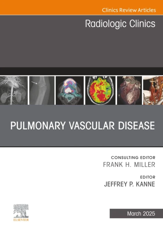 Pulmonary Vascular Disease, An Issue of Radiologic Clinics of North America: Volume 63-2 (The Clinics: Radiology, Volume 63-2)