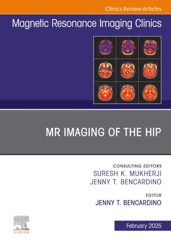 MR Imaging of the Hip, An Issue of Magnetic Resonance Imaging Clinics of North America: Volume 33-1 (The Clinics: Radiology, Volume 33-1)