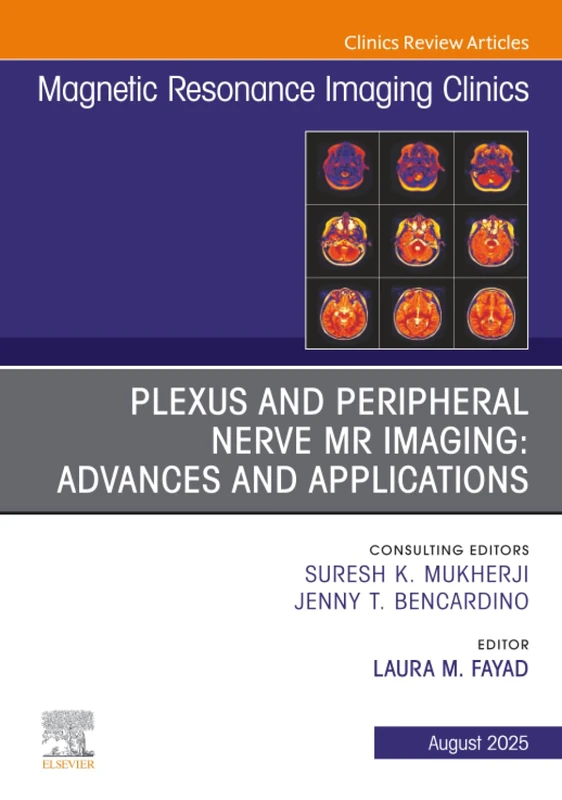Plexus and Peripheral Nerve MR Imaging: Advances and Applications, An Issue of Magnetic Resonance Imaging Clinics of North America: Volume 33-3 (The Clinics: Radiology, Volume 33-3)